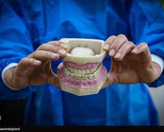 بیمه‌ 6 خدمت جدید دندان‌پزشکی در بیمه سلامت/ پیشنهاد پوشش بیمه‌ای 17 خدمت