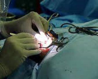 خدمات کاشت حلزون شنوایی زیرپوشش بیمه سلامت قرار گرفت